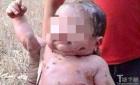 泰国一婴儿被捅14刀后又遭活埋 竟奇迹生还(组图)
