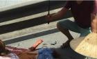 温州市区发生一起车祸！一名女子大腿被活活碾断！